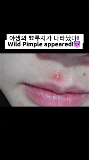 Wild Pimple appeared! 👿 My $1.5 Eevee evolution stone... ✨ 야생의 뾰루지가 나타났다! 나의 1.5달러짜리 이브이 진화석...