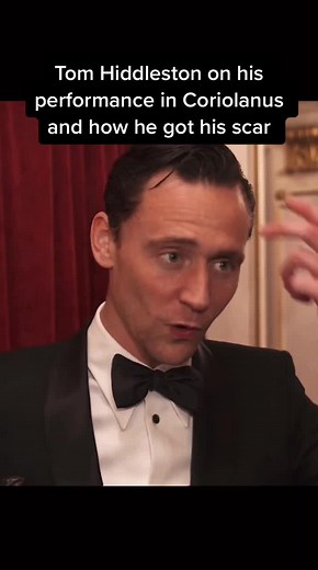 Tom Hiddleston Talks Coriolanus Performance and Scar Origin