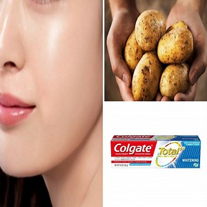 For skin lightening - Mix potato juice with lemon juice. As potato has bleaching properties, it can lighten dark skin in a natural way. Apply the mixture on the dark patches. Done regularly, the dark areas will be significantly lightened. | Health Tips