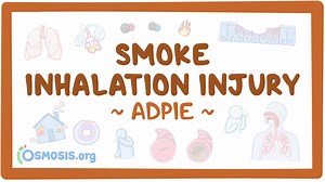 Smoke inhalation injury: Nursing process (ADPIE): Video, Causes, & Meaning | Osmosis