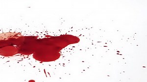 Blood Dripping Against White Background Slow Stock Footage Video (100% Royalty-free) 1070467174 | Shutterstock