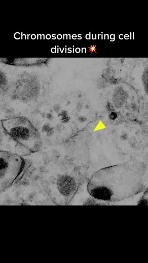 In this new capture, follow the yellow arrow to see where to focus. A cell is undergoing #mitosis and you can clearly see how its chromosomes start to appear as they condense. You can even make out individual chromosomes being juggled around and aligned at the cell equator before being separated. And as a #bonus, at the end, there's a #cell chimed in, that's a macrophage and you can see it eating a debries at the end too. Watching this is so therapeutic! #fyp #fypシ#trending#viral#biology#foryou