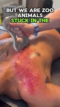 Guasha on Chest Wall - Breath Better #guasha #iastm #graston #physio