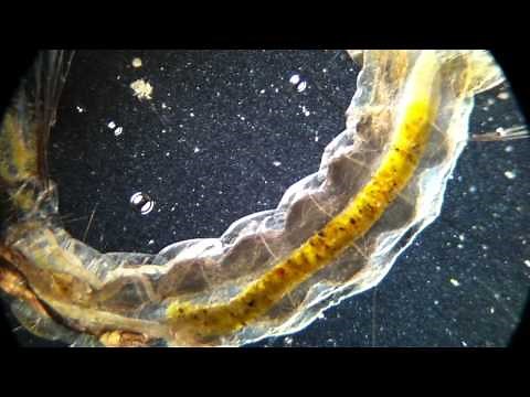 Dark field and Bright field