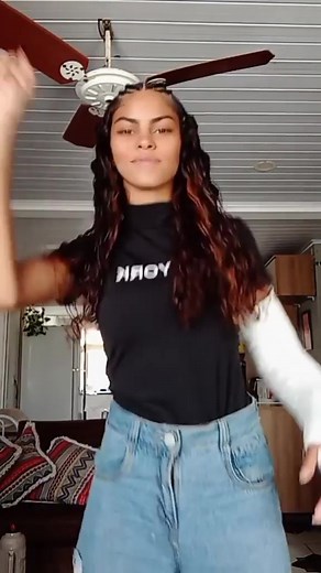 Long Arm Cast for Fractured Elbow and Wrist