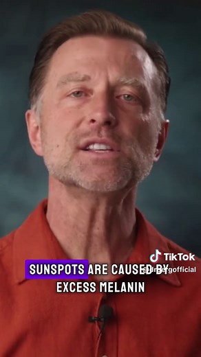 How to Get Rid of Sunspots Fast