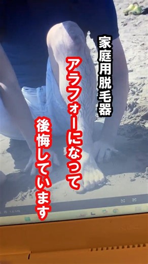 【家庭用脱毛器で脱毛】20代から毛深さに悩んでいました。こんなに効果があるならもっと早く始めればよかったです😭 #メンズ脱毛 #家庭用脱毛器 #脱毛#メンズ美容#アラフォー