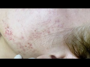 Satisfying Relaxing with Sac Dep Spa Video (#213)