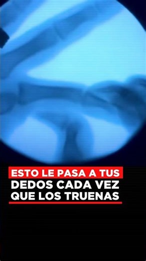 Esto le pasa a tus dedos cada vez que te los truenas