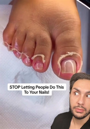 Avoid Dangerous Nail Practices: Proximal Nail Fold Care