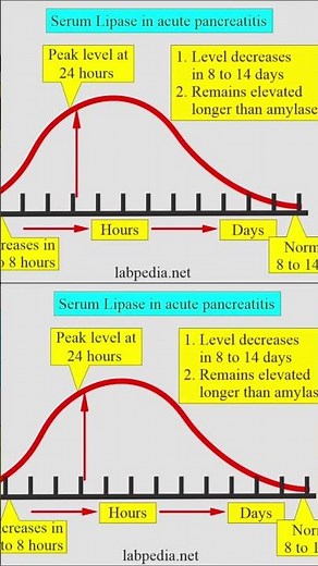La Amilasa y Lipasa en Pancreatitis Aguda #pancreas #pancreatitis