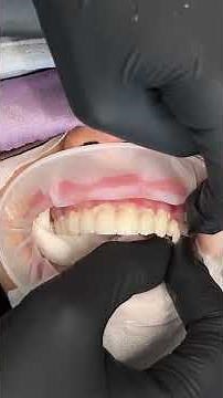 Delivering Beautiful Porcelain Veneers - Inside the Process