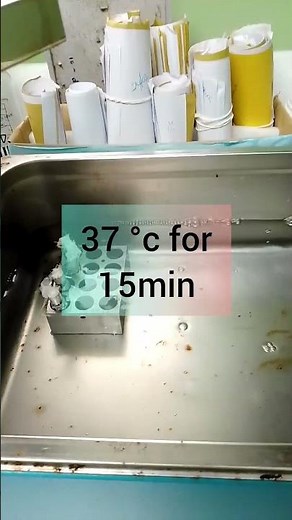 Reticulocyte Count: The Blood Test You Didn't Know About