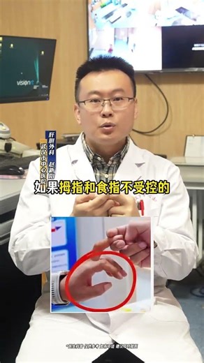 Quick 10-Second Self-Check for Cervical Spondylosis - Easy & Effective