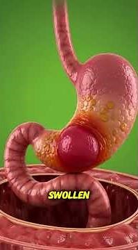 “What Beer Really Does to Your Gut – Shocking Anatomy Breakdown”