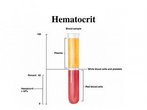 Hematocrit - SlideServe