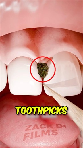 Stop Using Toothpicks! They're Hurting Your Teeth 😱🦷