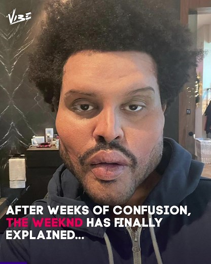 The Weeknd has finally explained why he wore face bandages and botox prosthetics. You do you, Abel 👊🏻 🎥 American Music Awards | Vibe FM