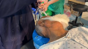 Soft swelling submandibular area | Dr Bakht Zada