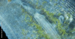 Leech family Glossiphoniidae under a microscope. Possibly the species Helobdella stagnalis. The work of the internal organs and the movement of the proboscis are visible.