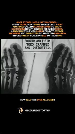 Shoe Stores X-Rayed Customers’ Feet #history #1920s
