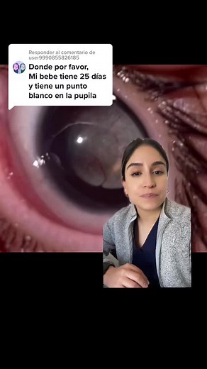 Leucocoria: ¿Qué significa el punto blanco en la pupila?