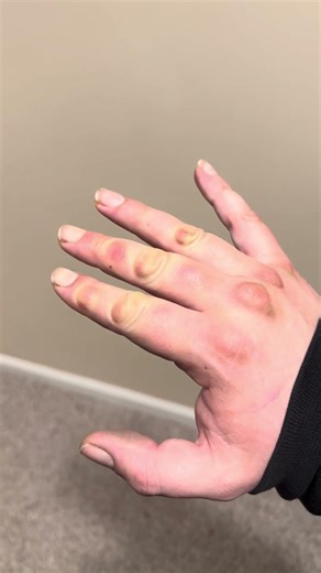 How to get gorilla hands