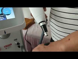 Grace Laser Guide and Tutorial