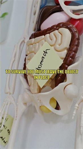 Stop! ⚠️ Never Pull Out Embedded Objects #firstaid #survival #emergency #health