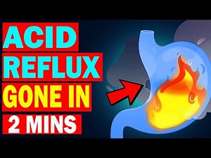 How To Treat Acid Reflux Naturally in Just 2 Minutes (Heartburn Relief)