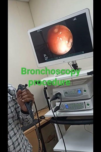 Bronchoscopy procedure