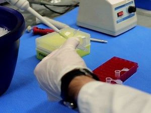 Protein Transfection of Mouse Lung