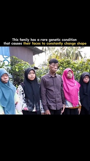 118K views · 1K reactions | This family lives with one of the rarest...