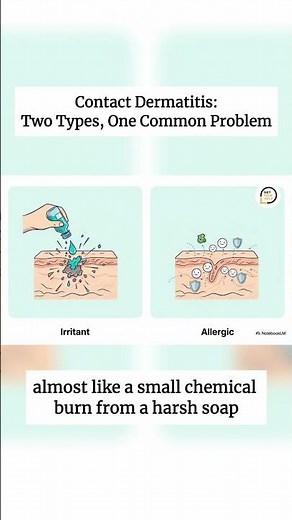 Explaining Contact Dermatitis – GetSkinHelp Patient Education
