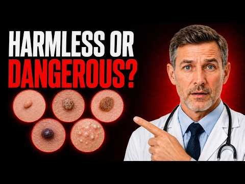 Skin Tag, Wart, or Cancer? How to Tell the Difference