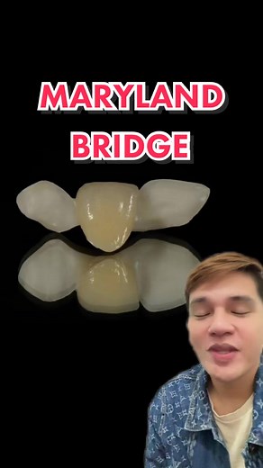 Understanding Maryland Bridge Cost and Procedure