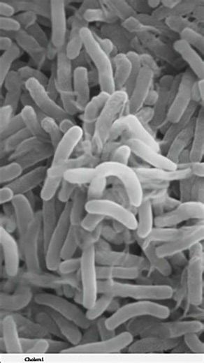 The Fastest Killer in the Water: Vibrio cholerae 💧💀 #microscopy #bacteriaworld #microbiology