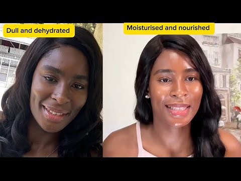 How I Achieved Attractive, Glowing Black Skin | Ingredients & Products That Works. Body Care