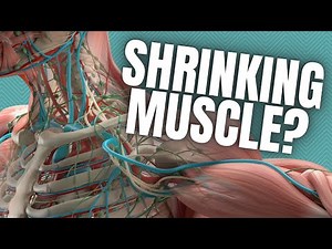 The REALITY Behind Muscle Soreness After Workouts (DOMS)