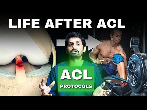 ACL Recovery Timeline: Rehabilitation Protocols -- ALL PHASES. #aclrecovery