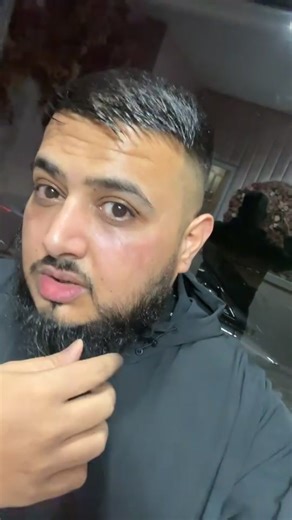 @Wakas.khalid1 in for a biorepeel facial & B12 injection today 🙌