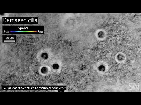 Cells’ hairlike cilia may keep coronavirus out of the lungs | Science News