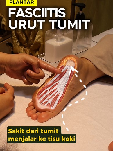 Cara Meredakan Sakit Tumit dengan Urutan
