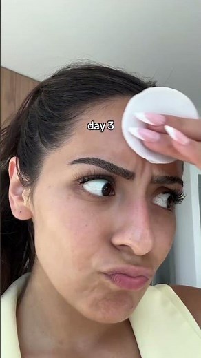 How to ACTUALLY get rid of forehead acne #skincareroutine #koreanskincare #fungalacne #tonerpad