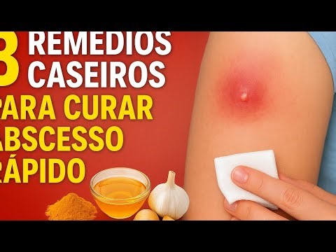 👉 “3 Powerful Home Remedies to Cure an Abscess Fast (Without Spending Almost Anything!)”