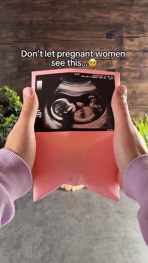 It’s a personalized memory sphere that plays your most cherished memories 🥹❤️ #pregnant #pregnancy #ultrasound #pregnancygift | Memory Sphere