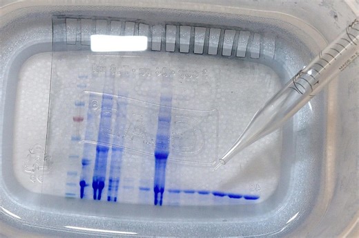 Mutated 'cicada' COVID variant detected in 25 states. What to know