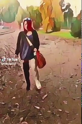 AJ rocking her big cast . . .#girlsincasts #castlife#cutegirls #shortshorts #fulllegcast #prettygirls #wtfhappened #yougogirl #castgirl #girlsnight #girlsjustwanttohavefun #girlsjustwanna #broken #plastercast#tough#toughgirls#hardluckgirl#thighhigh#thighhighboots#thighhighcast#goodluck