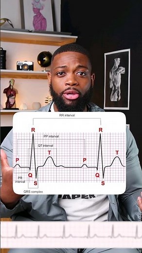 Normal Sinus Rhythm Explained! #ecg #ecginterpretation #sinusrhythm