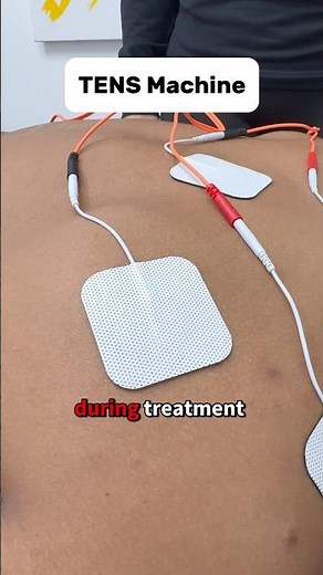 TENS Machine Explained #sportsmedicine #physiotherapy #injuryrehab